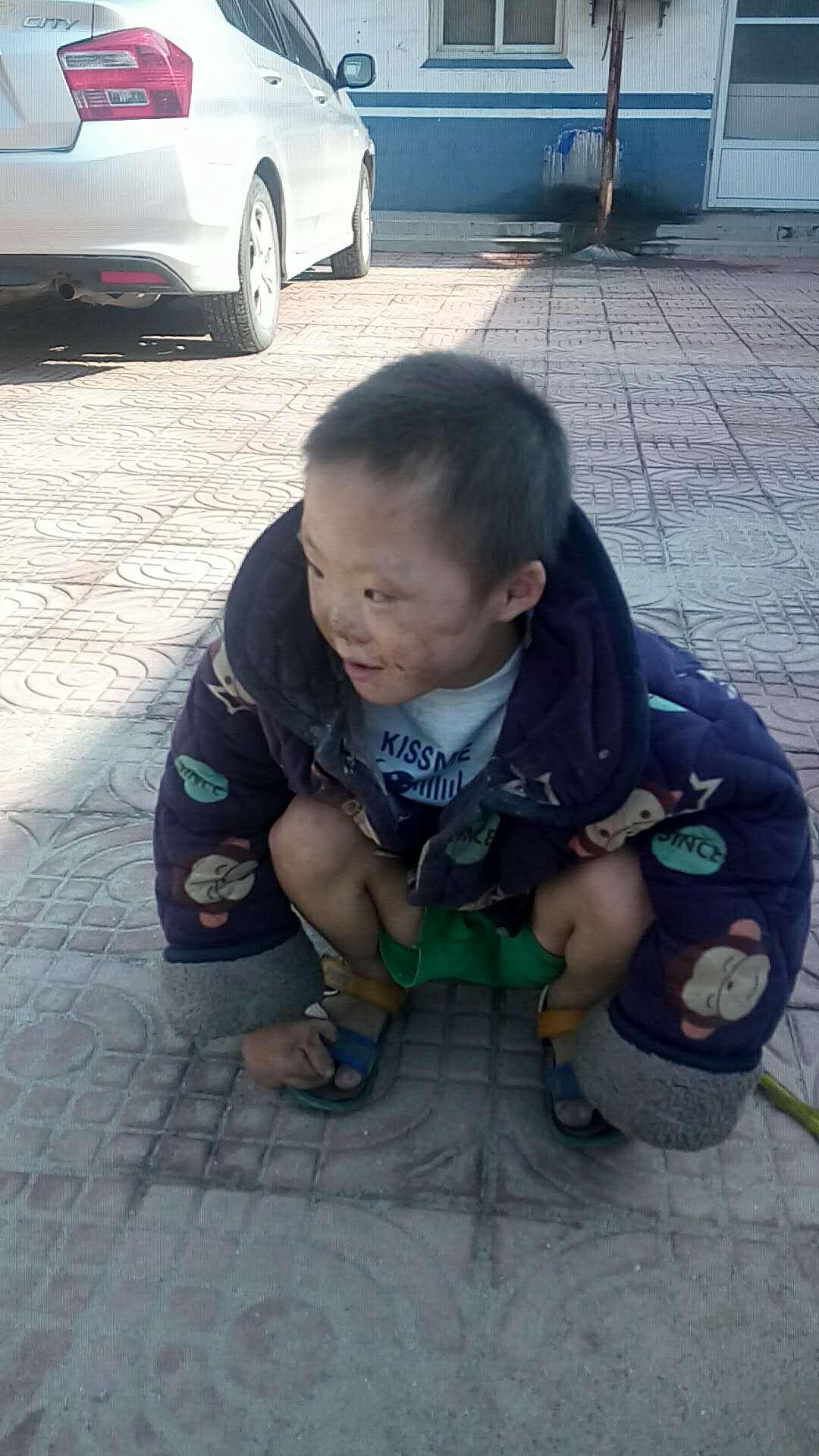 河北最新疑似病例分析及關(guān)注健康共抗疫情